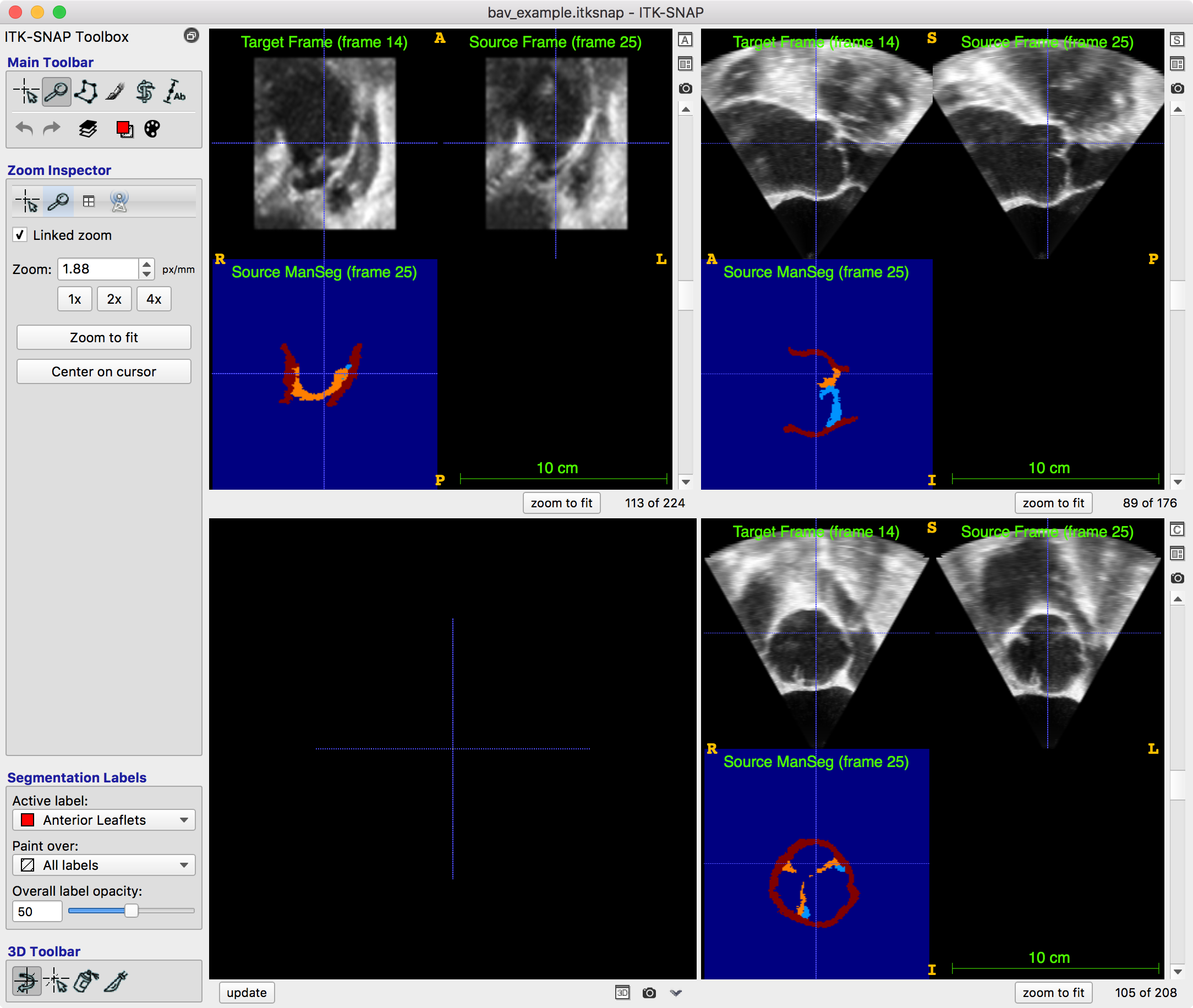 _images/dss_itksnap_bav_input.png